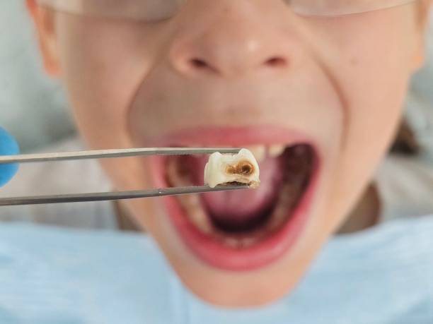 Best Same-Day Emergency Dental Services in Mcclure, PA